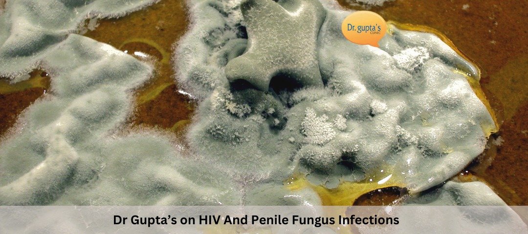 Dr Gupta’s on HIV And Penile Fungus Infections